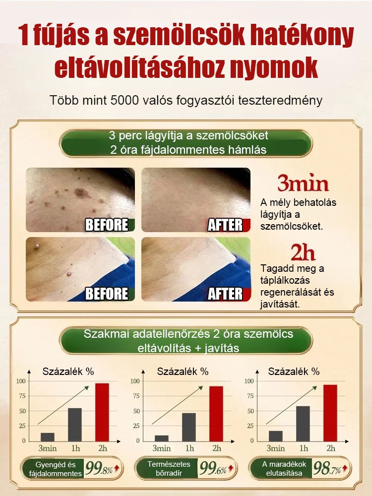 Timilk szemölcs elleni külső ápoló spray
