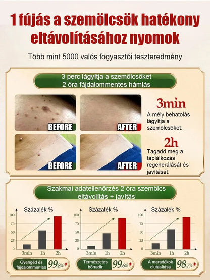 Timilk szemölcs elleni külső ápoló spray