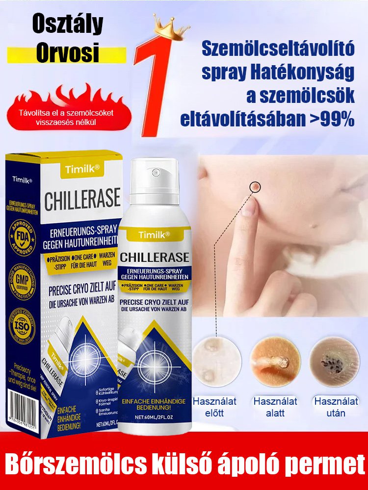 Timilk szemölcs elleni külső ápoló spray
