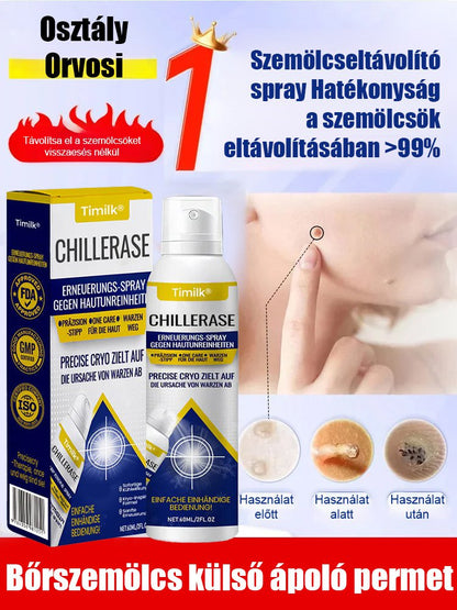 Timilk szemölcs elleni külső ápoló spray