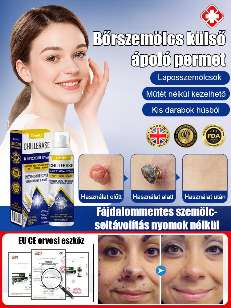 Timilk szemölcs elleni külső ápoló spray