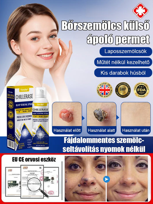 Timilk szemölcs elleni külső ápoló spray