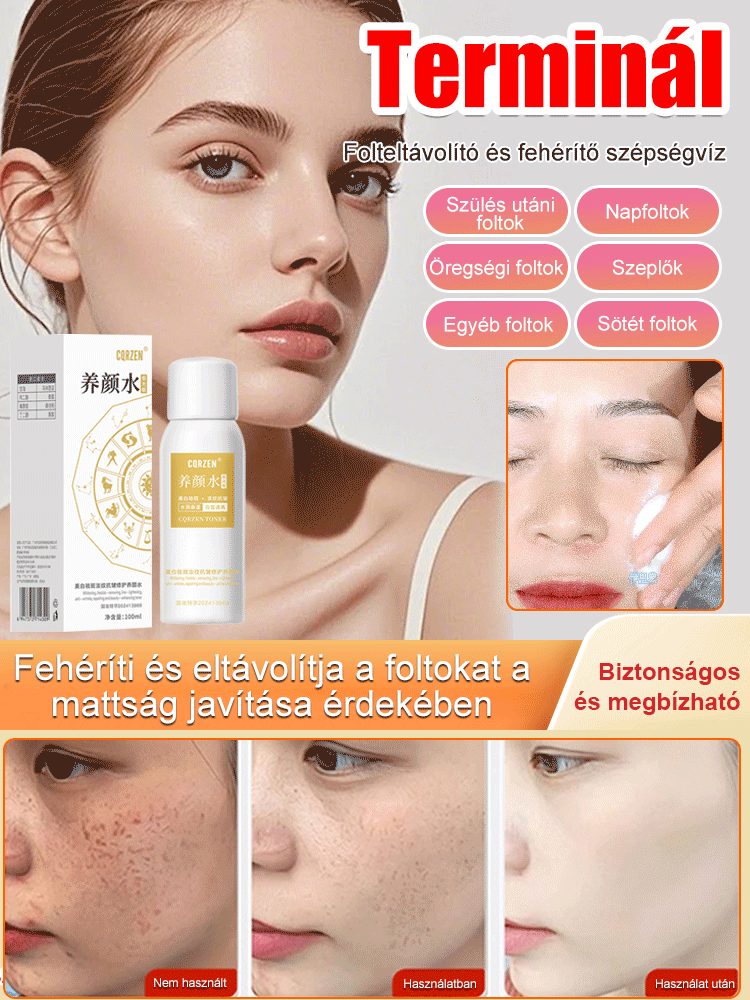【Arcfoltok eltávolítása】Folteltávolító permet - Egy spray az arc foltjainak eltávolítására, szuper hatékony!!