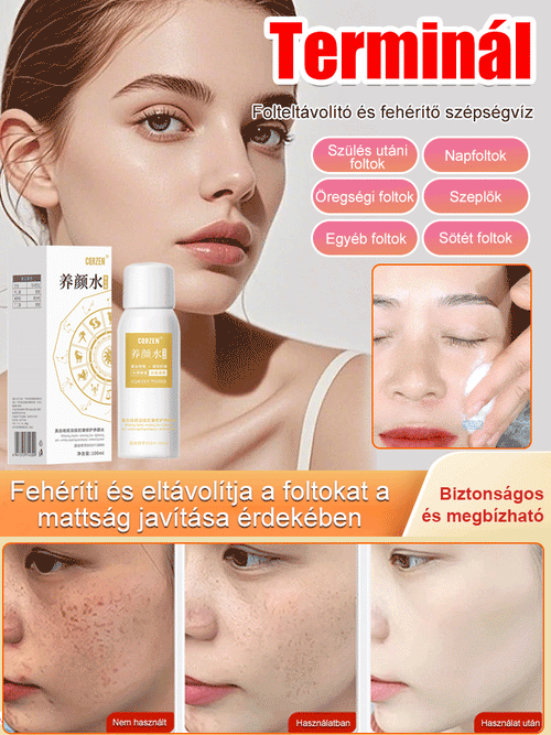 【Arcfoltok eltávolítása】Folteltávolító permet - Egy spray az arc foltjainak eltávolítására, szuper hatékony!!