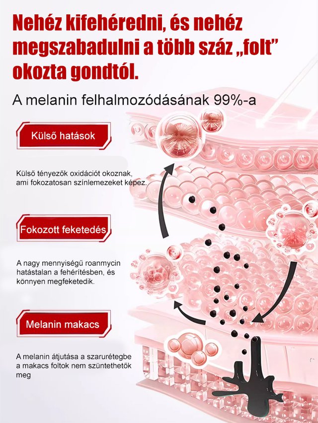 【Arcfoltok eltávolítása】Folteltávolító permet - Egy spray az arc foltjainak eltávolítására, szuper hatékony!!