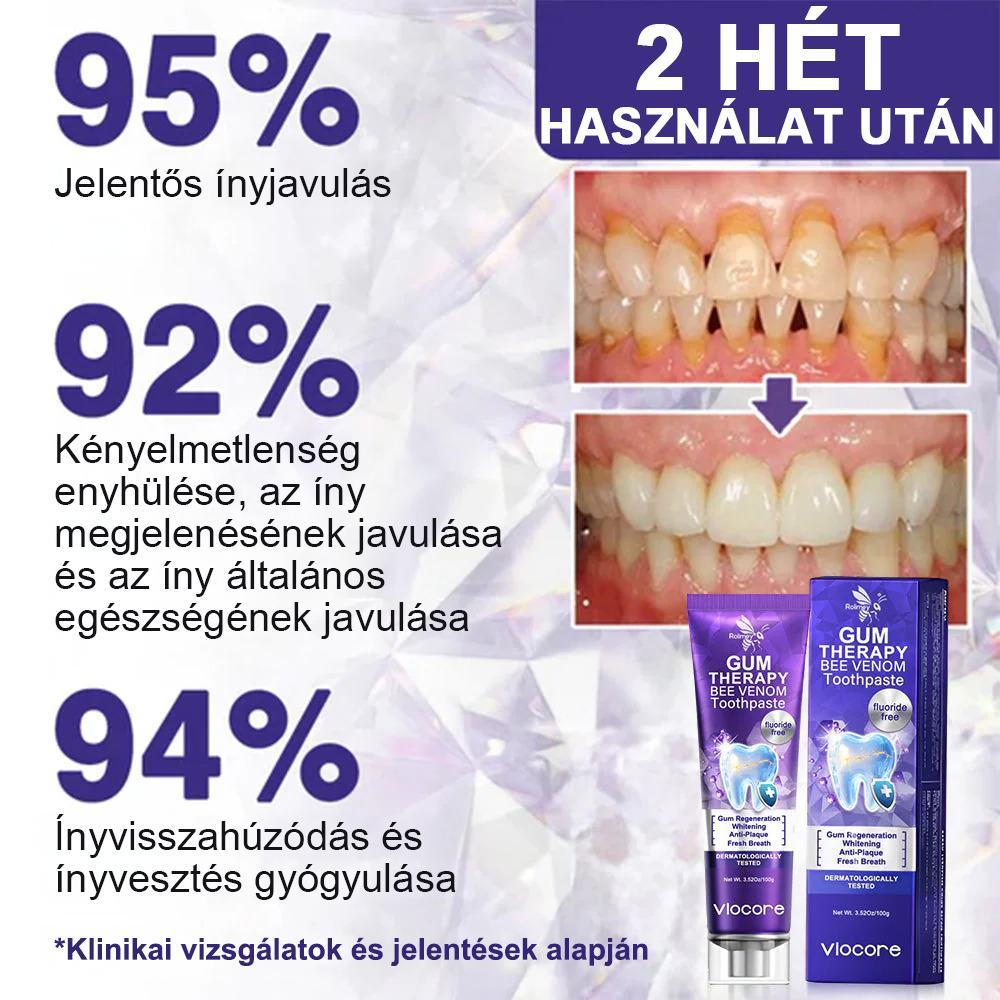 Timnlik® VioCore Méhméreg Fogkezelő Fogkrém🔥