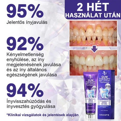 Timnlik® VioCore Méhméreg Fogkezelő Fogkrém🔥