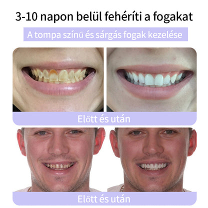 🦷🦷CleraNature® Fogak Helyreállító Ásványi Por🦷🦷