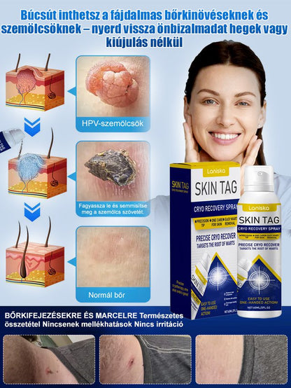 Bőrszemölcs külső ápoló permet Bőrszemölcs külső ápoló permet ！！！Mondj búcsút a szemölcsöknek, légy magabiztos minden pillanatban!