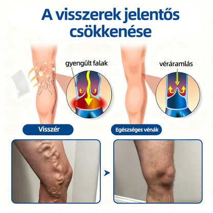 🇭🇺Yutuof® 👩‍⚕️VeinTarget mikrotűs tapasz⚡Azonnali enyhülés hosszú távú eredmények-🔥🔥🔥