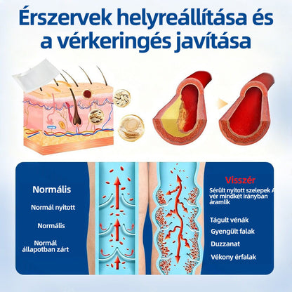 🇭🇺Yutuof® 👩‍⚕️VeinTarget mikrotűs tapasz⚡Azonnali enyhülés hosszú távú eredmények-🔥🔥🔥