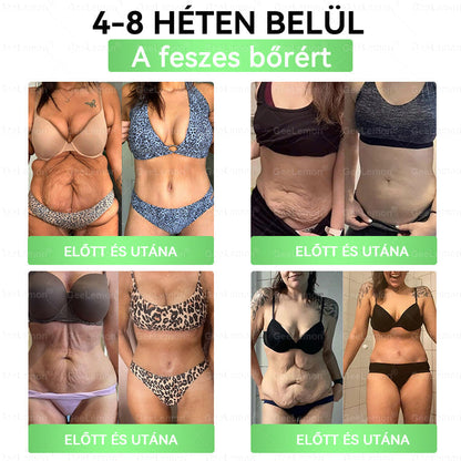 🌿Ajánlott a Semmelweis Kórház által · 👩‍⚕️BENU hivatalos üzlet| 🎁 𝐆𝐞𝑒𝐿𝑒𝐦𝐨𝐧® Glumasetide 8 az 1-ben Karcsú és Egészséges Nano Mikrotűs Tapasz 🇭🇺
